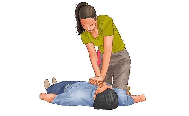 CPR 방법